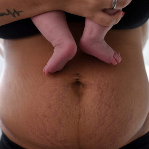 From Clearance at 6 Weeks to Actually Feeling Ready: Bridging the Gap